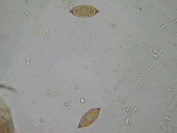 Discina perlata (Fr.: Fr.) Fr.